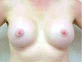 Patient # 63642 After Photo # 2