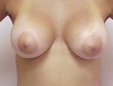 Patient # 57509 After Photo # 2