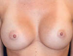 Patient # 39943 After Photo # 2