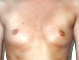 Patient # 17889 Before Photo # 1