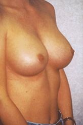 Patient # 34286 After Photo # 2
