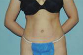 Patient # 86297 After Photo # 2