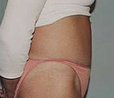 Patient # 65674 After Photo # 2