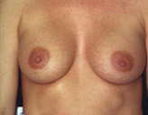 Patient # 38138 After Photo # 2