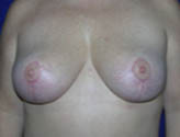 Patient # 69886 After Photo # 2