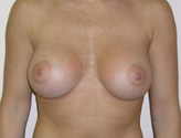 Patient # 74373 After Photo # 2