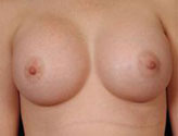 Patient # 37649 After Photo # 2
