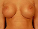 Patient # 78280 After Photo # 2