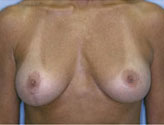 Patient # 99714 After Photo # 2