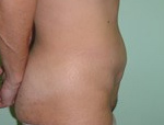 Patient # 54184 After Photo # 4