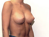 Patient # 60224 After Photo # 2
