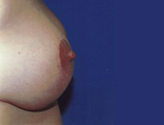Patient # 73572 After Photo # 4