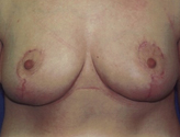 Patient # 50207 After Photo # 2