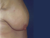 Patient # 50207 Before Photo # 3
