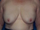 Patient # 19745 After Photo # 2