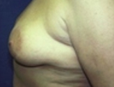Patient # 19153 After Photo # 4