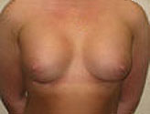 Patient # 27150 After Photo # 2