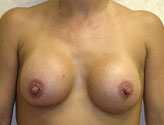 Patient # 89683 After Photo # 2