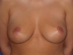 Patient # 62119 After Photo # 2