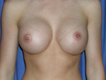 Patient # 29173 After Photo # 2