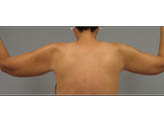 Patient # 24366 After Photo # 2