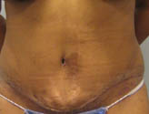 Patient # 28469 After Photo # 2