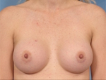 Patient # 55869 After Photo # 2