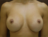 Patient # 12591 After Photo # 2