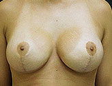 Patient # 35967 After Photo # 2