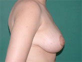 Patient # 74123 After Photo # 6