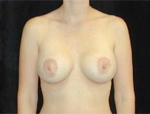 Patient # 96972 After Photo # 2