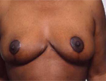 Patient # 25724 After Photo # 2