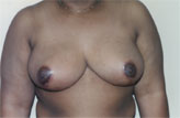 Patient # 79538 After Photo # 2