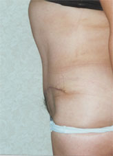 Patient # 48669 After Photo # 2