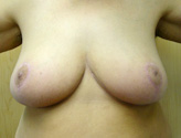Patient # 13047 After Photo # 2