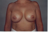 Patient # 76490 After Photo # 2
