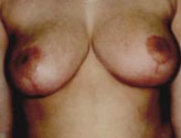 Patient # 25806 After Photo # 2