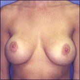 Patient # 22599 After Photo # 2