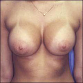 Patient # 27154 After Photo # 2
