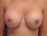 Patient # 59567 After Photo # 2