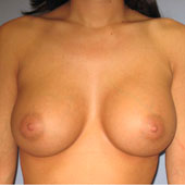 Patient # 86512 After Photo # 2