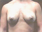 Patient # 58376 After Photo # 2