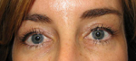 Patient # 14373 After Photo # 2