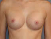 Patient # 44235 After Photo # 2