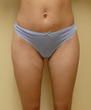Patient # 59979 After Photo # 2