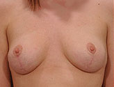 Patient # 30789 After Photo # 2