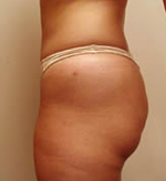 Patient # 58169 After Photo # 2