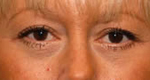 Patient # 14192 After Photo # 2