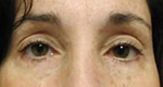 Patient # 49389 After Photo # 2