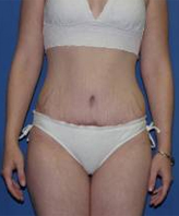 Patient # 56408 After Photo # 2